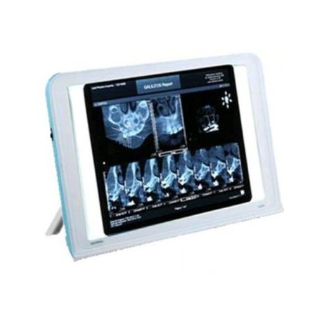 Dental X-Ray Tipo de Cine de Visor de Cajas de la Vista la Pared del LED Iluminado Turística de Montaje Luna