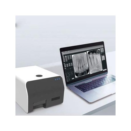 VRN Escáner de placas de fósforo dental scanner de placas de fósforo radiología digital
